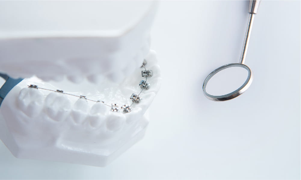 矯正歯科治療中のリスクコントロール